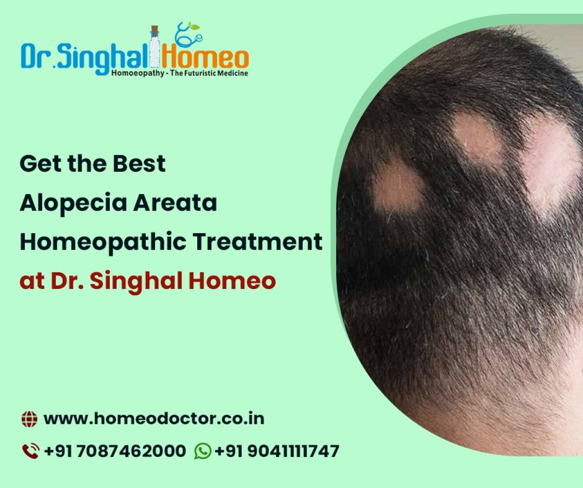 Alopecia Areata Homeopathic Treatment - A Time-tested & Proven Option For Great Hair Health