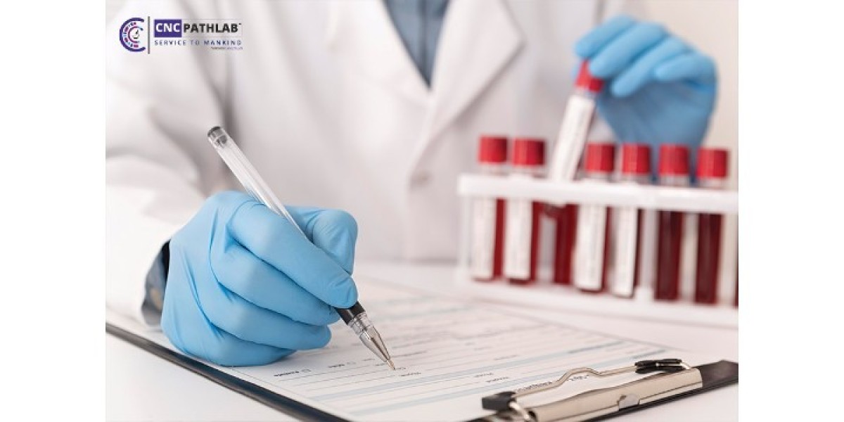 When is the Best Time to Schedule a Blood Test Home Collection in Delhi?