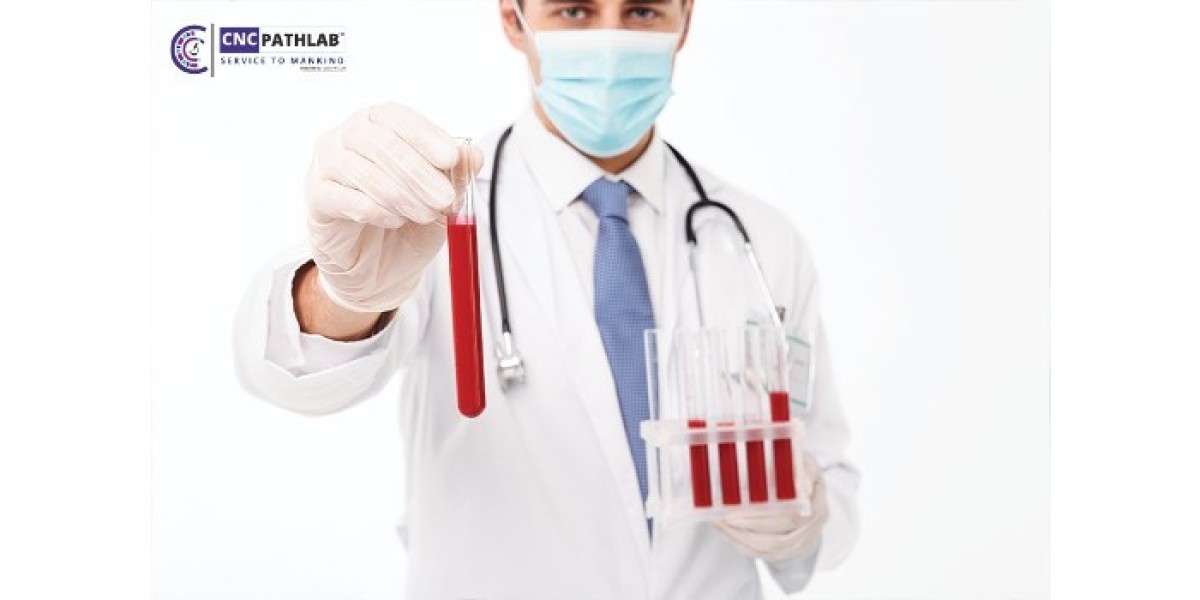 Why CNC Path Lab is the Best Blood Test Lab in Delhi