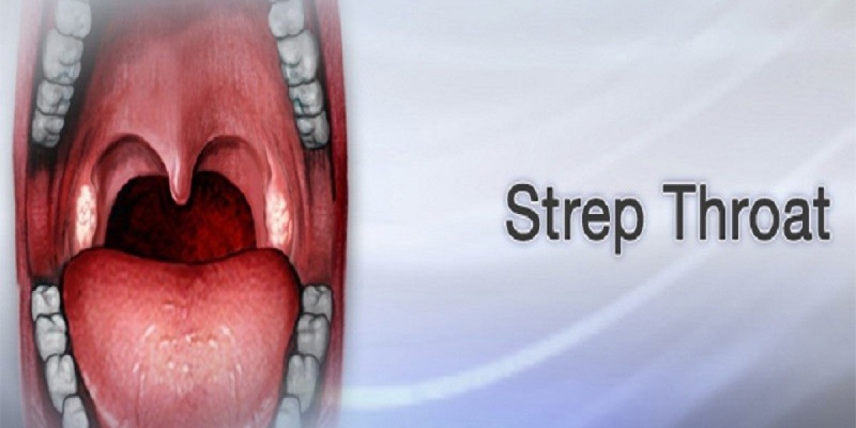 The Ultimate Guide to Help You Can You Get Strep Throat without Tonsils