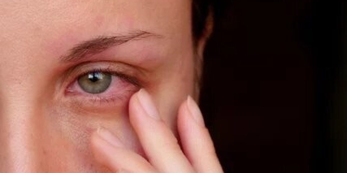 Red Eye: Causes and Treatment