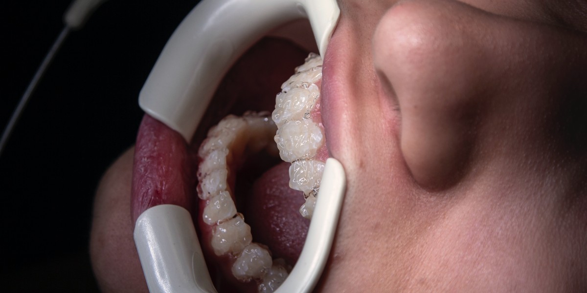 Innovations in Dentistry: The Rise of Airflow Tooth Polishing