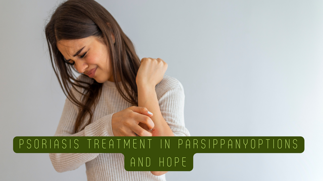 Psoriasis Treatment in Parsippany: Options and Hope | TechPlanet