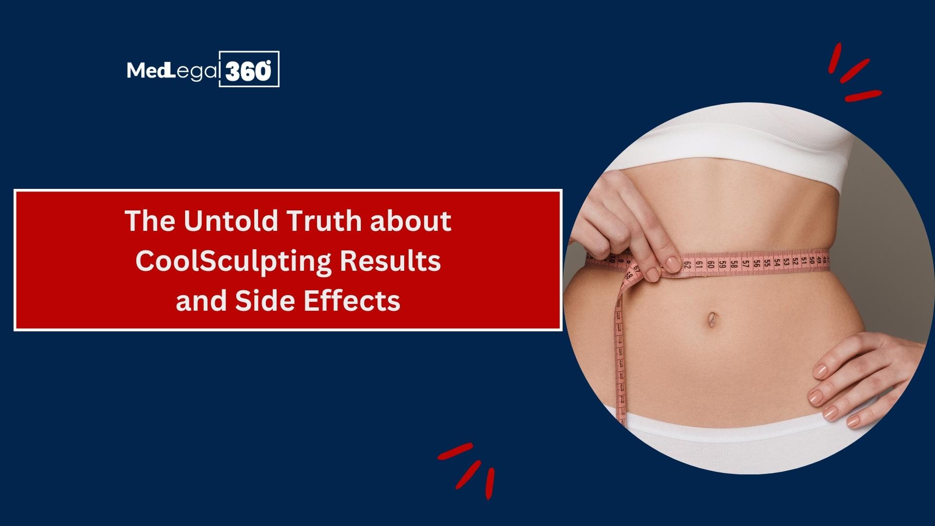 The Untold Truth about CoolSculpting Results and Side Effects