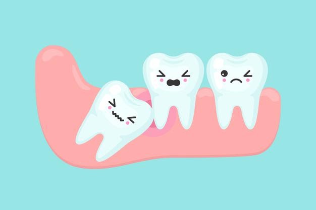 Wisdom Tooth Pain: Symptoms, Causes, Remedies & Relief | Smile Oracles