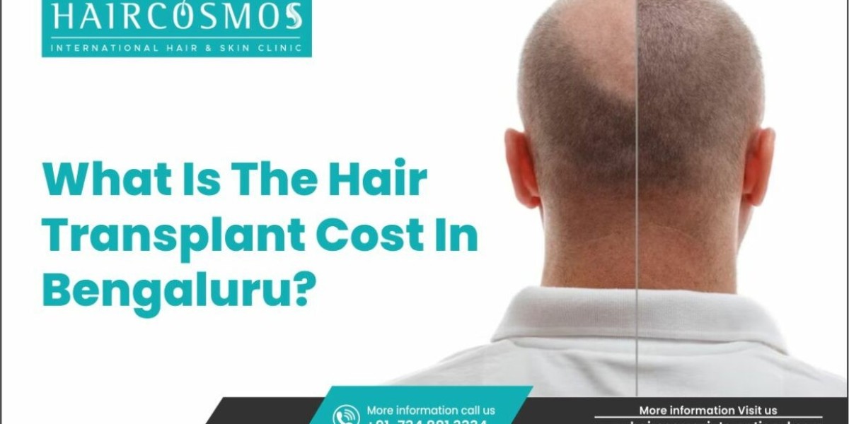 Hair Transplant Cost in Bengaluru