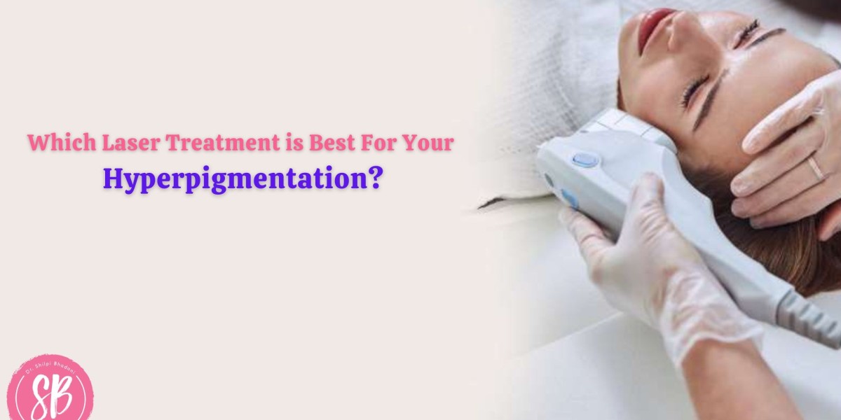 Which Laser Treatment is Best For Your Hyperpigmentation?