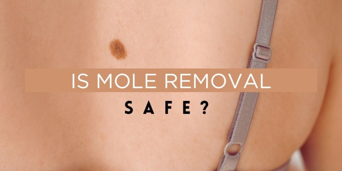 Is Mole Removal Safe?