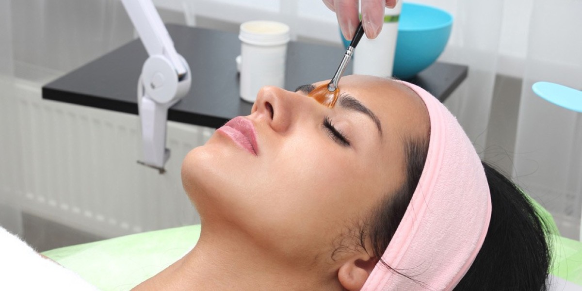 Unveiling the Radiance: A Comprehensive Guide to Derma Peels for Sensitive Skin in Rockville