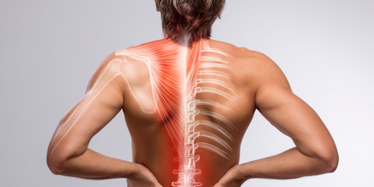 Muscle Pain - Causes, Types & Best Treatment