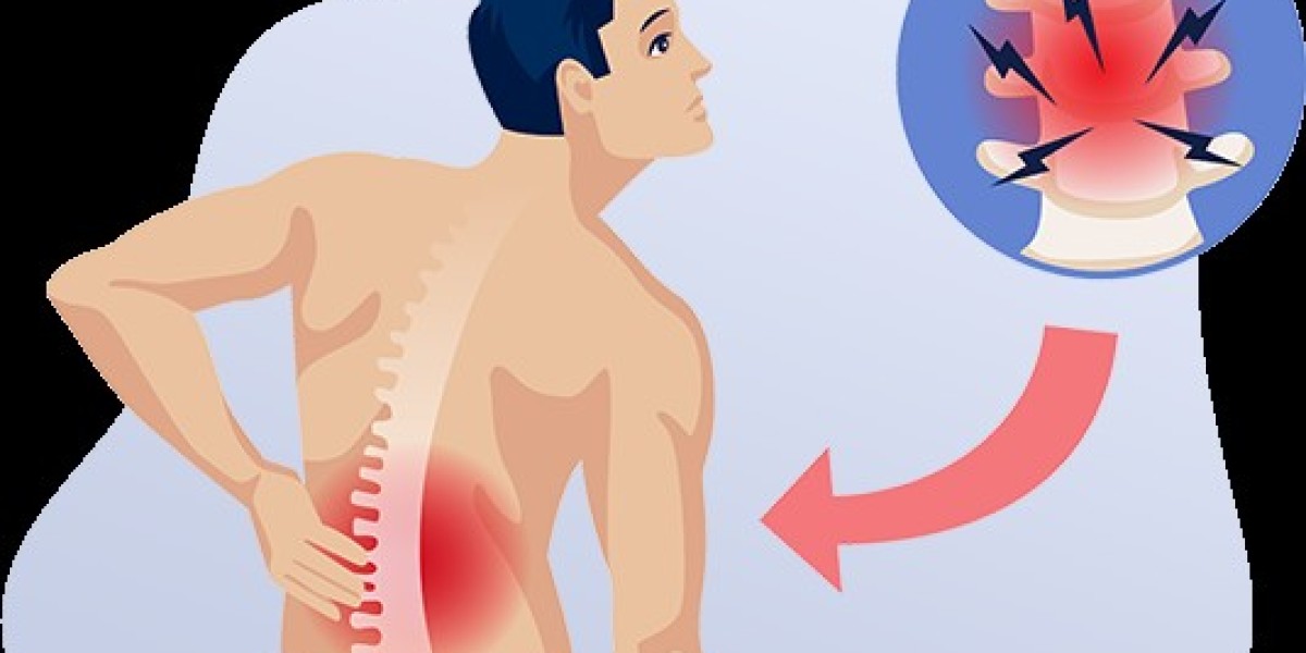 Muscle Pain (Chronic Soft Tissue Pain): Causes & Treatment | Genericshub