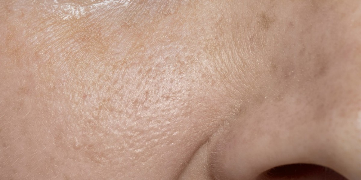 Why are My Pores Big? 4 Factors That Come Into Play