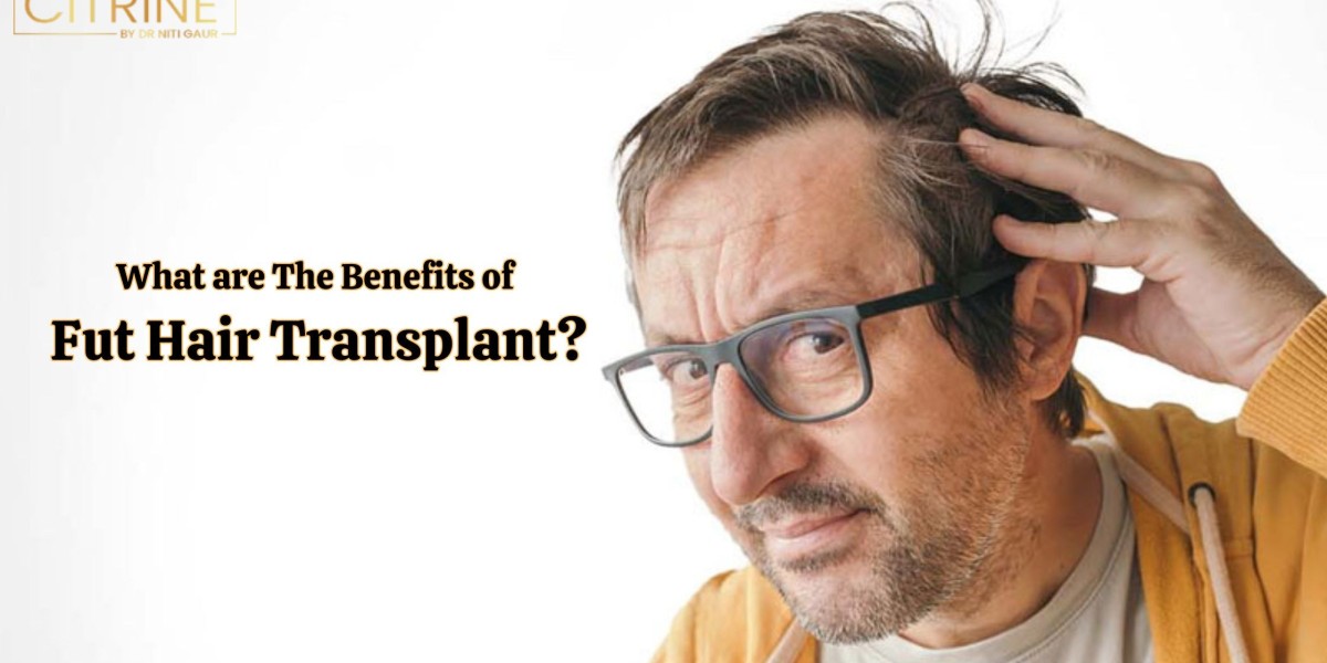 What Are The Benefits of Fut Hair Transplant?