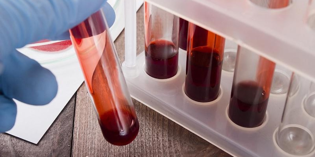 Blood Plasma Derivatives Market Size, Industry Growth, Report Forecast 2023-2028