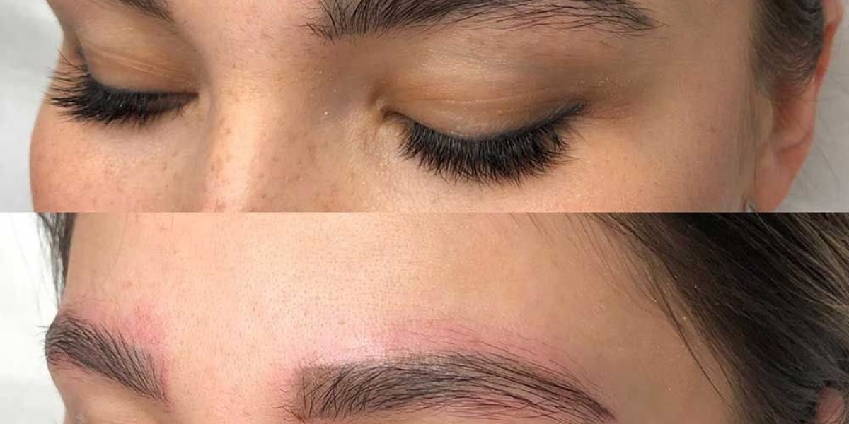 Why Choose Celibre for Permanent Makeup Removal in Torrance, CA?