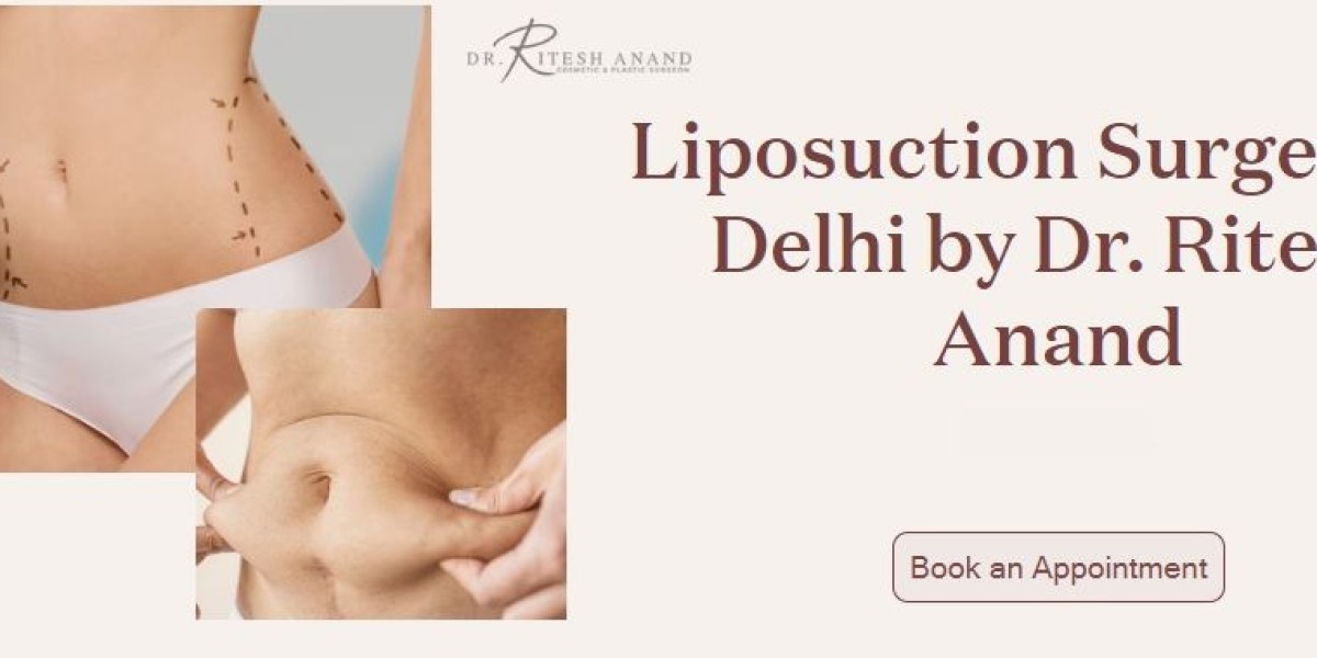 Liposuction Surgery in Delhi by Dr. Ritesh Anand