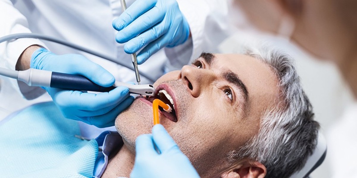 Maintaining Oral Health: The Role of Professional Dental Cleaning in Root Canal Avoidance