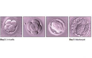Implantation of Blastocysts Transfer & IVF Embryos in Humans - Elixir IVF