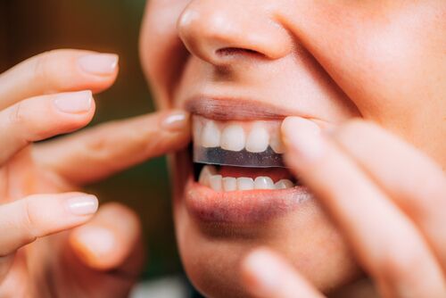 Elevate Your Smile: The Ultimate Guide to the Best Whitening Strips