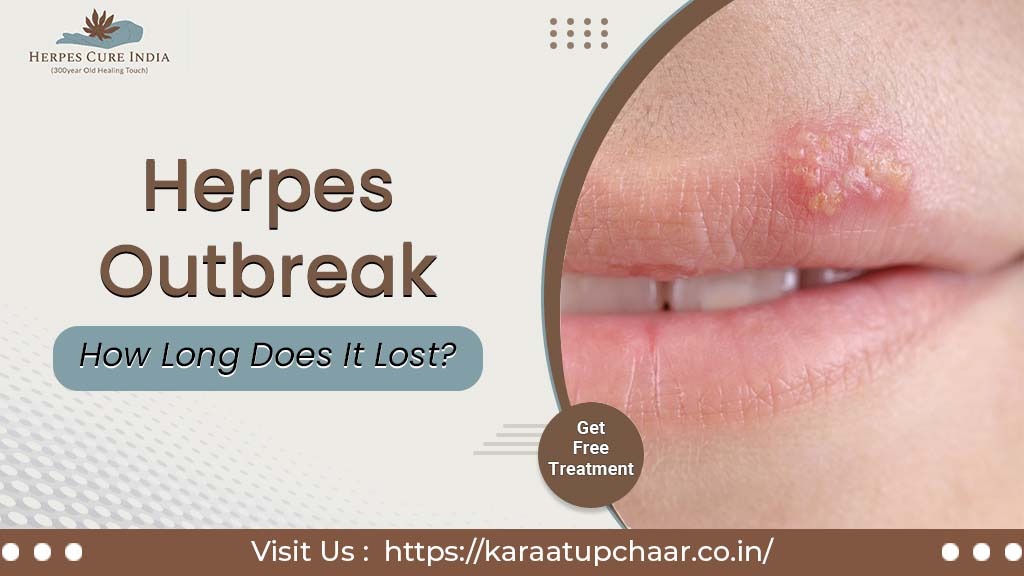 Herpes Outbreak - How long does it lost?