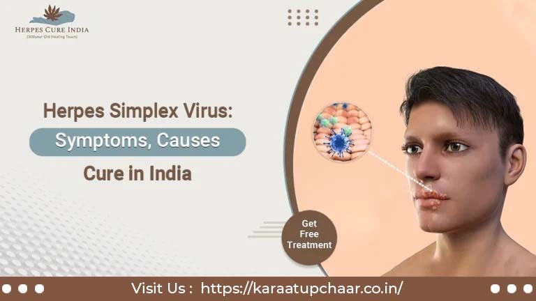 Herpes Simplex Virus: Symptoms, Causes & Cure in India
